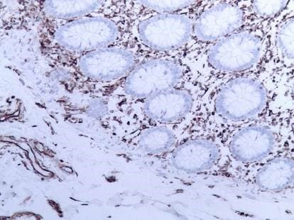 IHC-plus™ Vimentin Antibody (clone V9)