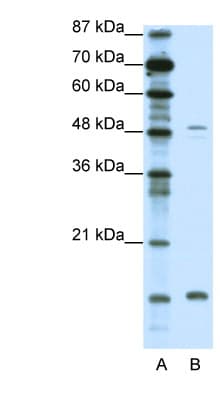 FBN1 / Fibrillin 1 Antibody (N-Terminus)