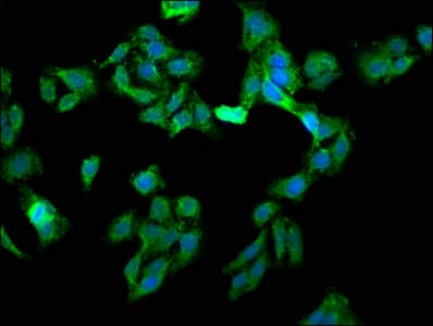 Polyclonal Rabbit anti-Human EIF3G Antibody (aa2-320, WB)