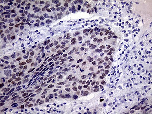 TSEN34 Antibody (clone OTI6B3, Carrier-free)