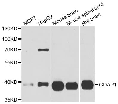 Polyclonal Rabbit anti-Human GDAP1 Antibody (IHC, WB)