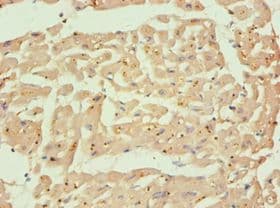Polyclonal Rabbit anti-Human CAPN1 / Calpain 1 Antibody (aa20-330, IHC)