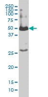 SMAD1 Antibody (clone 1D3)