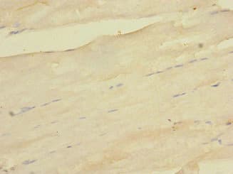 Polyclonal Rabbit anti-Human PDK3 Antibody (IHC, WB)