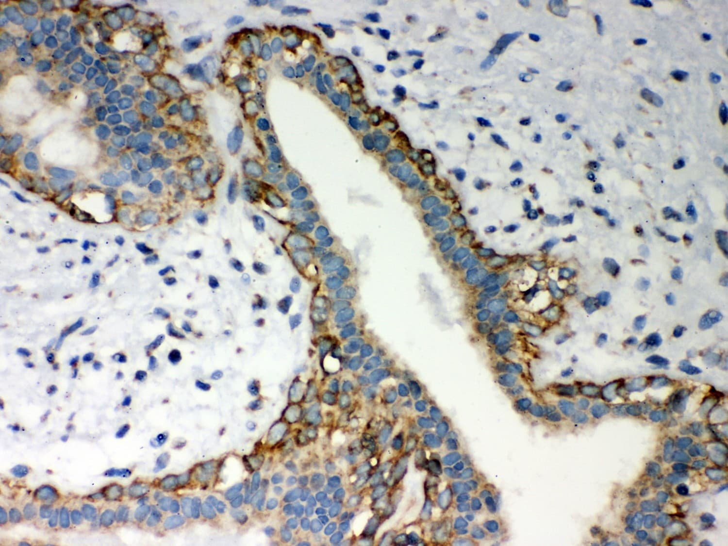 Polyclonal Rabbit anti-Human MTDH / Metadherin Antibody (aa101-270, IHC, WB)