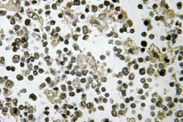 DDX55 Antibody (Gln133)