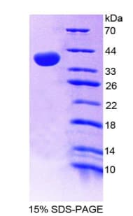 Human VLDLR Protein (Recombinant His-T7)