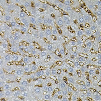 ASAH2 Antibody