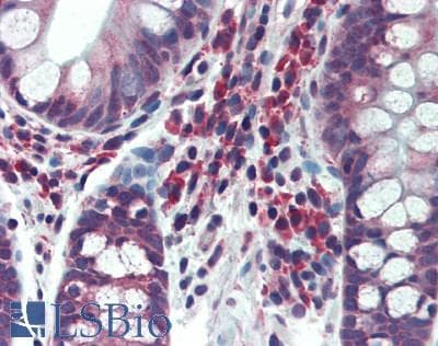 IHC-plus™ Polyclonal Rabbit anti-Human CARMA1 / CARD11 Antibody (aa1104-1154, IHC, WB)