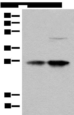 COA7 / SELRC1 Antibody