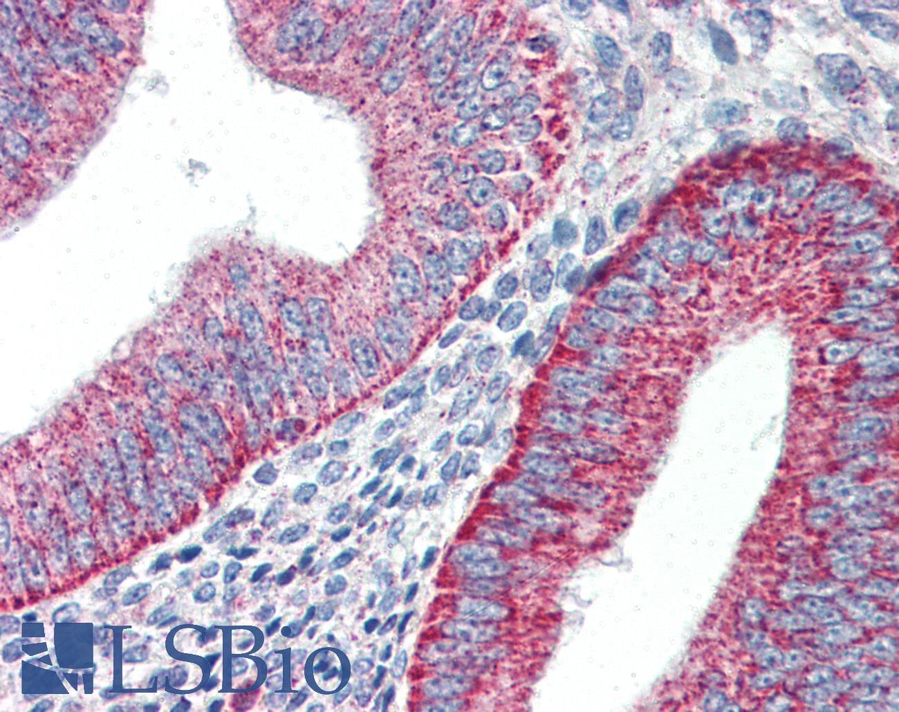 PathPlus™ Polyclonal Rabbit anti-Human HAVCR1 / KIM-1 Antibody (IHC, WB)