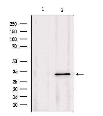 PYCR1 Antibody