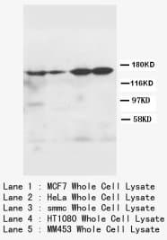 ROCK2 Antibody (N-Terminus)