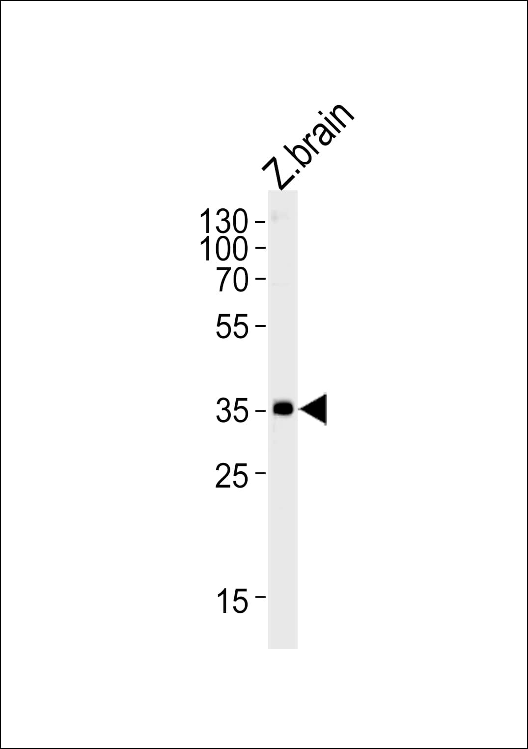 Polyclonal Rabbit anti-Zebrafish GNB1 Antibody (aa1-30, WB)