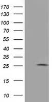 Monoclonal Mouse anti-Human AK3 / Adenylate Kinase 3 Antibody (clone OTI3G1, IHC, IF, WB)