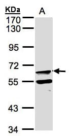 FPGT Antibody (aa146-453)