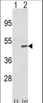 TRIB2 Antibody (aa1-30)