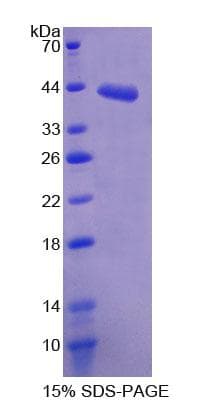 Mouse SDHC Protein (Recombinant His-GST)
