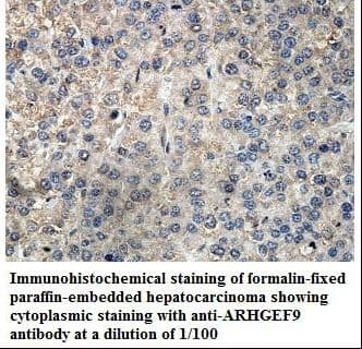 Polyclonal Rabbit anti-Human ARHGEF9 / Collybistin Antibody (aa66-255, IHC, WB)
