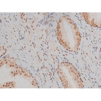 AP-1 / JUND Antibody (phospho-Ser255)