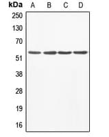 Polyclonal Rabbit anti-Human ABI1 / SSH3BP1 Antibody (Internal, WB)