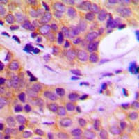 Polyclonal Rabbit anti-Human PLCG2 / PLC Gamma 2 Antibody (Internal, IHC, WB)