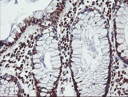 FMR1 / FMRP Antibody (clone OTI1C6)
