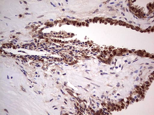 LGALS3 / Galectin 3 Antibody (clone OTI2F1)