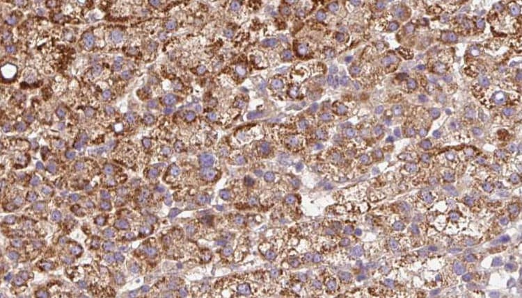 ADGRB2 / BAI2 Antibody