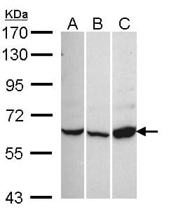 CACNB1 Antibody
