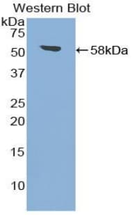 TGM1 / Transglutaminase Antibody (aa562-800, Biotin)