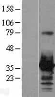 HOXC8 Protein (Over-Expression Lysate Myc-DDK (Flag))