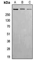 ATM Antibody (phospho-Ser1981)