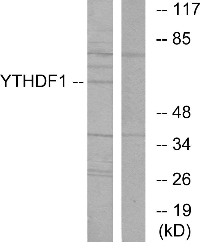 IHC-plus™ YTHDF1 Antibody (aa1-50)
