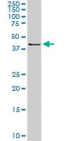 Monoclonal Mouse anti-Human RASSF8 Antibody (clone 2G1, IHC, IF, WB)