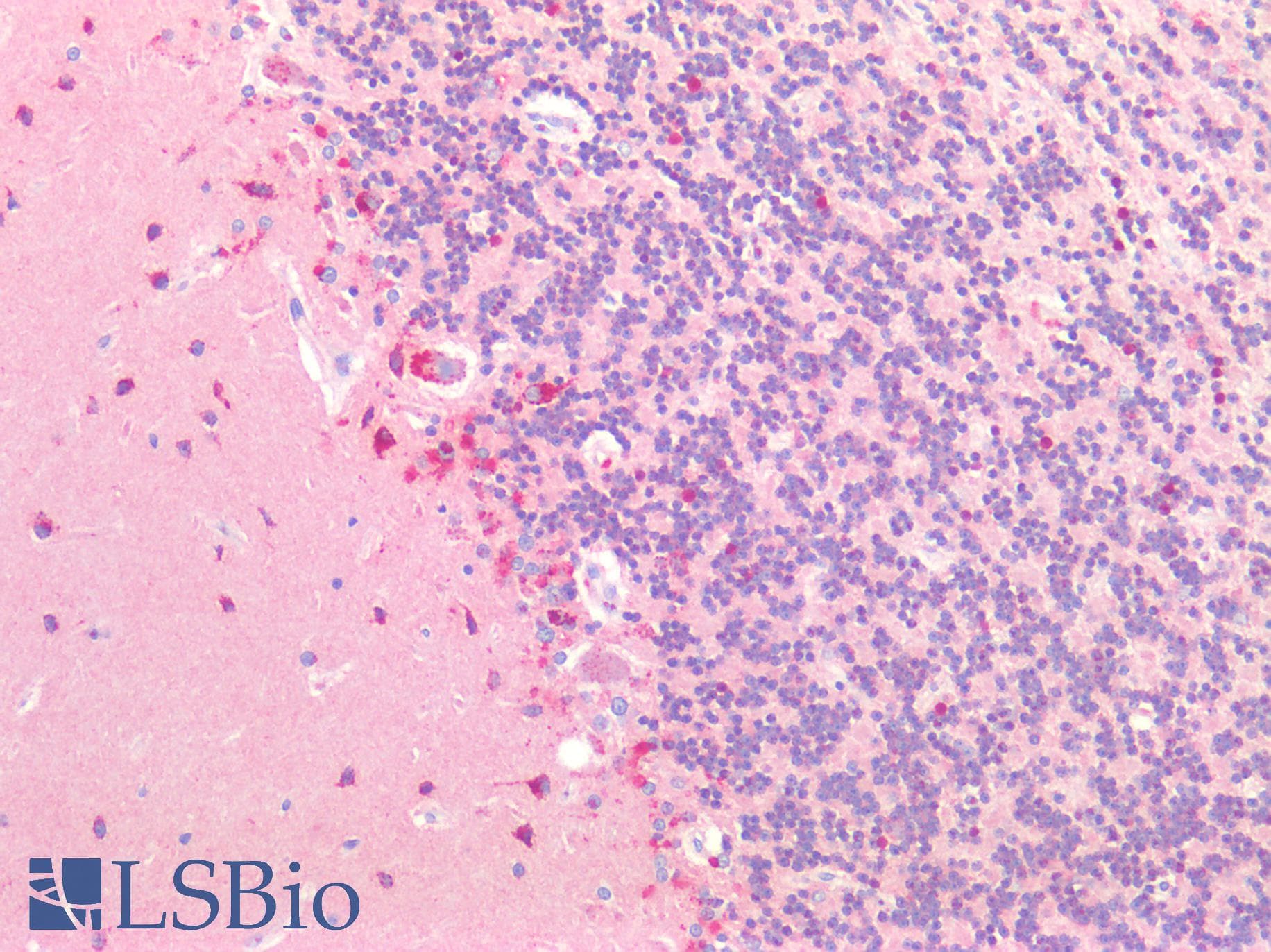 PathPlus™ NPTX1 Antibody