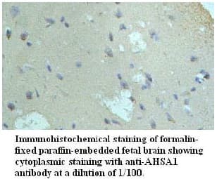 AHSA1 / AHA1 Antibody (aa55-290)