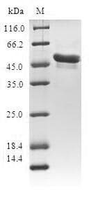 Human AES / Groucho Protein (Recombinant GST, N-terminus)