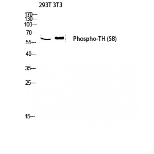 TH / Tyrosine Hydroxylase Antibody (1-80 aa)