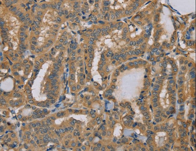 Polyclonal Rabbit anti-Human MYL3 Antibody (IHC, WB)
