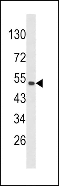 PLEKHO1 / CKIP-1 Antibody (aa49-77)