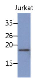 NBL1 / DAN Antibody (clone AT38G8)