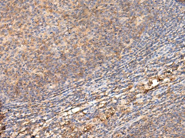 ADGRA1 / GPR123 Antibody