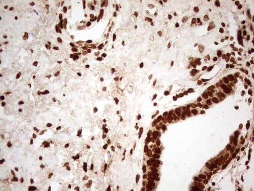 Monoclonal Mouse anti-Human ALOX5 / 5-LOX Antibody (clone OTI3F1, aa18-364, IHC, WB)