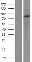 PKP3 / Plakophilin 3 Protein (Over-Expression Lysate Myc-DDK (Flag))