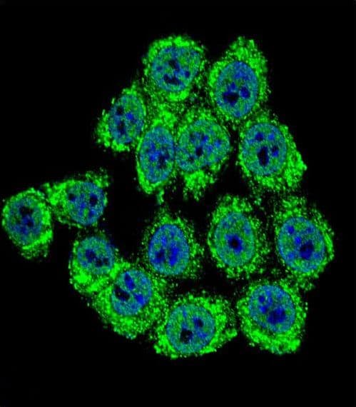 NF2 / Merlin Antibody (aa65-95)