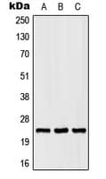 SCN2B Antibody (Internal)