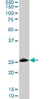 RNF141 Antibody (clone 6D9)