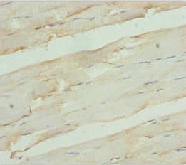 Polyclonal Rabbit anti-Human RDH12 / LCA3 Antibody (IHC)