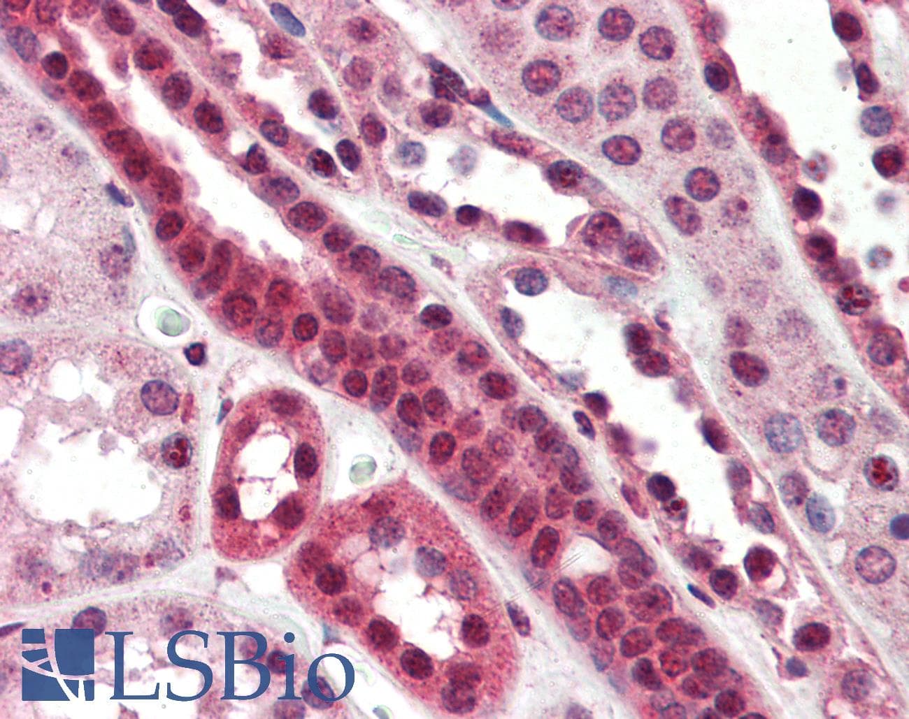 IHC-plus™ TCF3 / E2A Antibody (aa522-535)